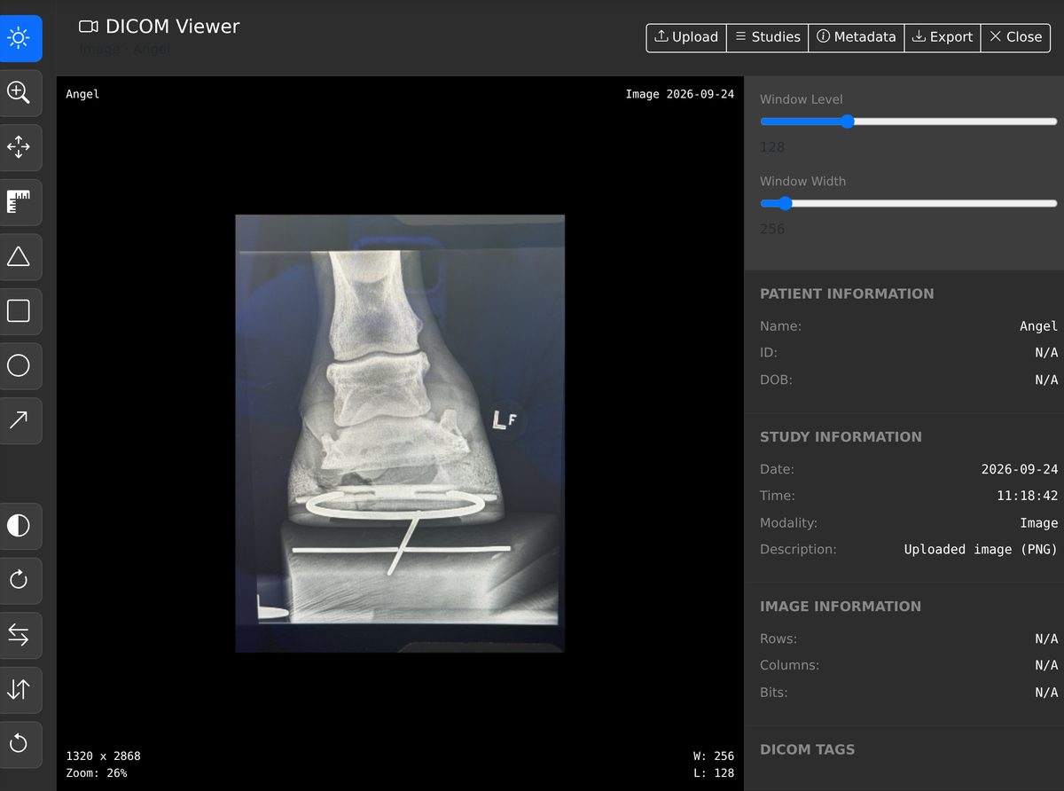 The built-in DICOM viewer showing a lateral radiograph of a horse's foot with window level and width sliders, measurement and annotation tools down the left, and patient, study and image information on the right.